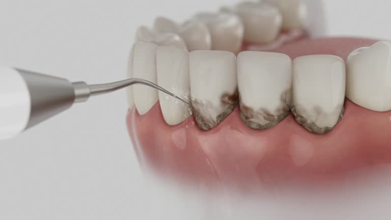 Reliable Tooth Extraction contractor in Routt County County, CO by Dentist Open Now